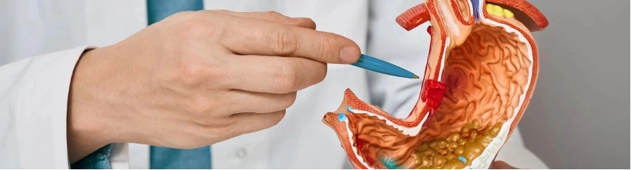 gastroplastia endoscopica